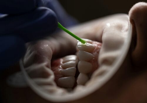 Terapiuli-mkurnaloba